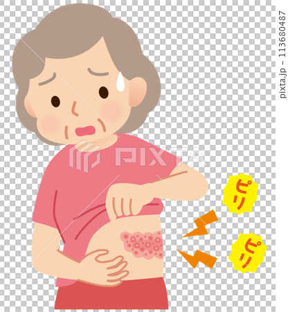 Elderly woman suffering from pain due to shingles Symptoms Elderly woman suffering from pain due to shingles Symptoms 113680487