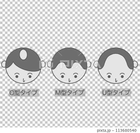 Hair disease Skin disease People with thinning hair 113680540