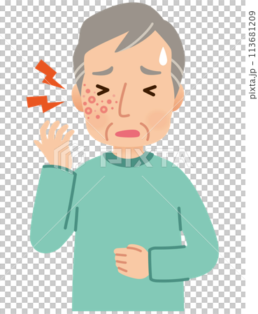 帯状疱疹ができて痛みがある高齢者男性　症状 113681209