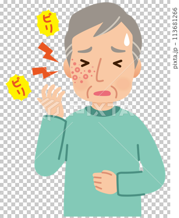 帯状疱疹ができて痛みがある高齢者男性 症状 帯状疱疹ができて痛みがある高齢者男性 症状 113681266