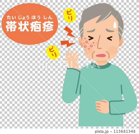 帯状疱疹ができて痛みがある高齢者男性　症状 113681348