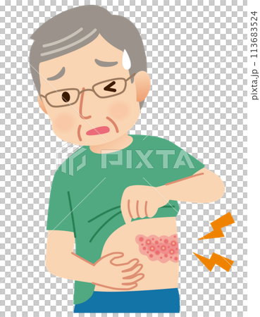 Elderly man suffering from pain due to shingles Symptoms Elderly man suffering from pain due to shingles Symptoms 113683524