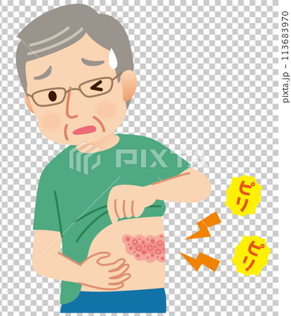 帯状疱疹ができて痛みがある高齢者男性　症状 113683970