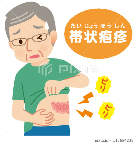 帯状疱疹ができて痛みがある高齢者男性 症状 帯状疱疹ができて痛みがある高齢者男性 症状 113684239