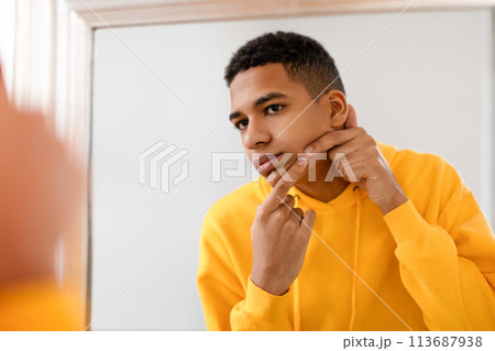 Teen guy examines acne in the mirror, skin health Teen guy examines acne in the mirror, skin health 113687938