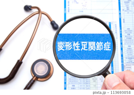 変形性足関節症 医療イメージ 変形性足関節症 医療イメージ 113693058