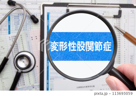 変形性股関節症　医療イメージ 113693059