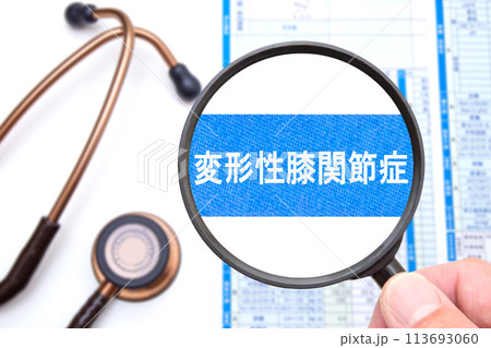 変形性膝関節症 医療イメージ 変形性膝関節症 医療イメージ 113693060