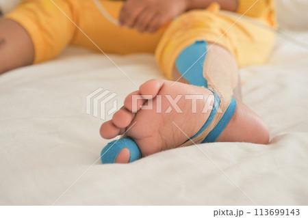 Elastic therapeutic blue tape applied to child leg. Kinesio Taping therapy for injury Elastic therapeutic blue tape applied to child leg. Kinesio Taping therapy for injury 113699143