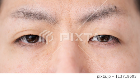 ミドル男性　目元　アップ 113719605