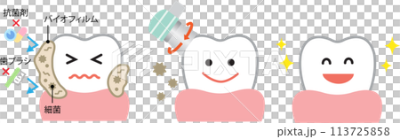 去除牙齒生物膜 113725858