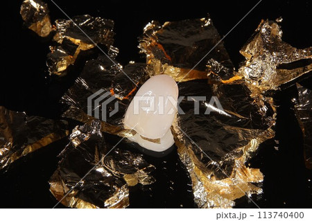 歯医者さんできれいな歯にしたい 113740400