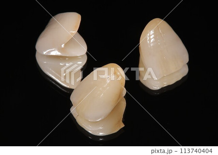 歯医者さんできれいな歯にしたい 113740404