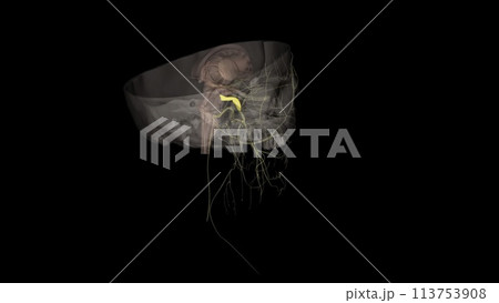 The trigeminal ganglion is located lateral to the cavernous sinus, in a depression of the temporal bone 113753908