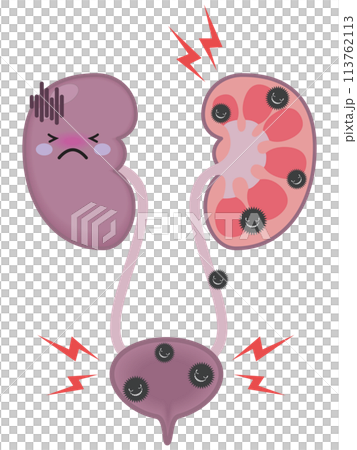 不健康な腎臓と腎臓のキャラクター 113762113