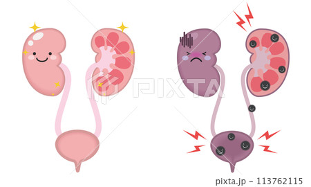泌尿器と腎臓のキャラクター 113762115