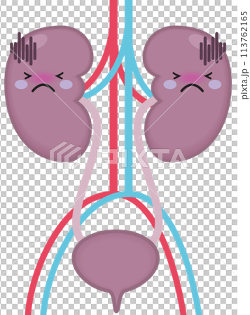 不健康な腎臓と腎臓のキャラクター 113762165