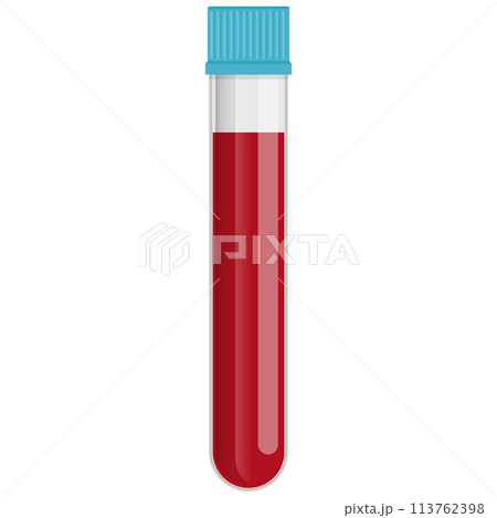 血液サンプル 113762398