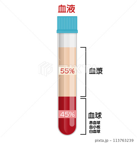 血液サンプル 113763239