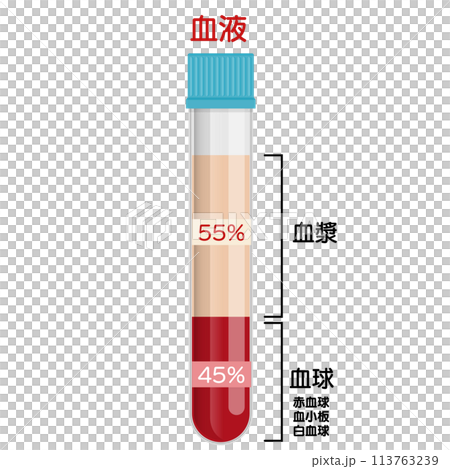 血液サンプル 113763239
