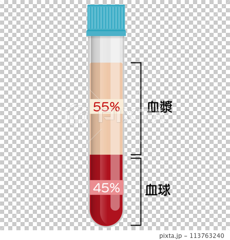 Blood samples 113763240