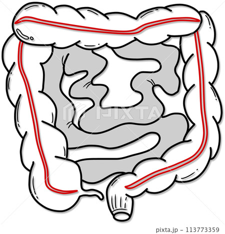illustration of human intestine anatomy created by black and red line 113773359