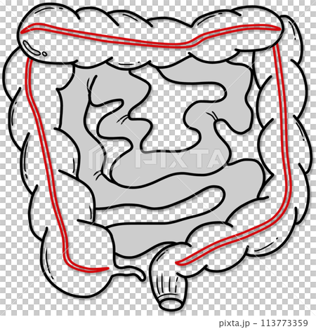 illustration of human intestine anatomy created by black and red line 113773359
