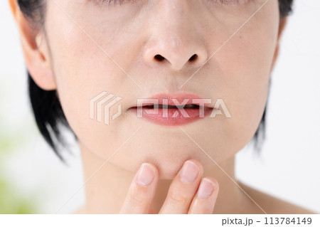 ビューティー　ほうれい線　悩み 113784149