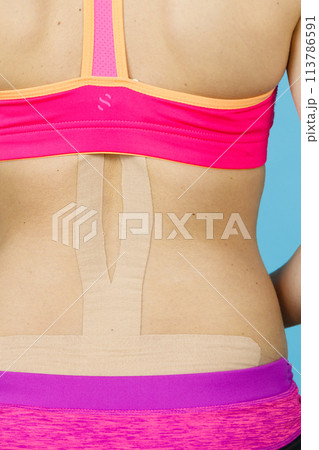 Woman with medical kinesio taping on back 113786591