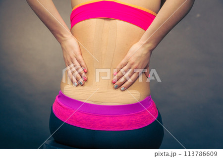 Woman with medical kinesio taping on back 113786609