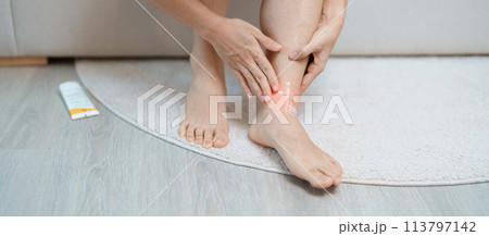 Arthritis and Muscle Pain Relief Cream concept. woman having leg pain due to Ankle Sprains or Achilles Tendonitis and Shin Splints ache. injuries, health and medical concept Arthritis and Muscle Pain Relief Cream concept. woman having leg pain due to Ankle Sprains or Achilles Tendonitis and Shin Splints ache. injuries, health and medical concept 113797142