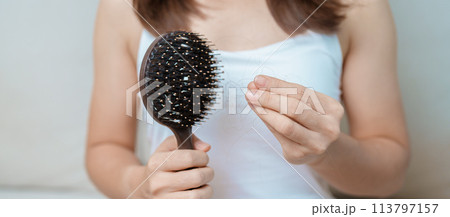Hair loss problem, Balding , Beauty treatments and health care concepts asian woman holding holding comb with hair loss, young female hold hairbrush and brushing with fall hair from scalp Hair loss problem, Balding , Beauty treatments and health care concepts asian woman holding holding comb with hair loss, young female hold hairbrush and brushing with fall hair from scalp 113797157