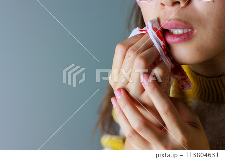 血の出た口元をハンカチで抑える女性 血の出た口元をハンカチで抑える女性 113804631