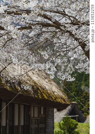 世界遺産 菅沼合掌造り集落の春景色 113852259