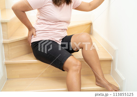 Asian lady fall down the stairs and pain at hip and waist because slippery surfaces. Asian lady fall down the stairs and pain at hip and waist because slippery surfaces. 113855125