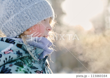 Girl in winterwear on frosty day 113860164