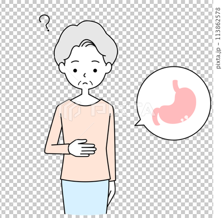 一位患有良性胃息肉且無症狀的老年婦女的插圖 一位患有良性胃息肉且無症狀的老年婦女的插圖 113862578