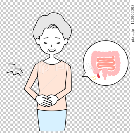 急性闌尾炎 一位患有胃痛的老年婦女的插圖 113903398