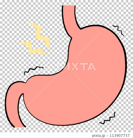 Illustration of stomach cramps 113907737