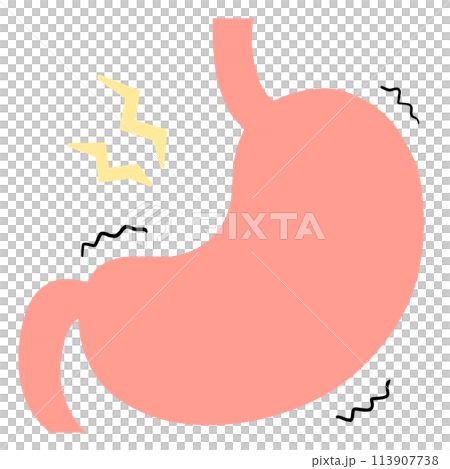 胃痙攣のイラスト 113907738