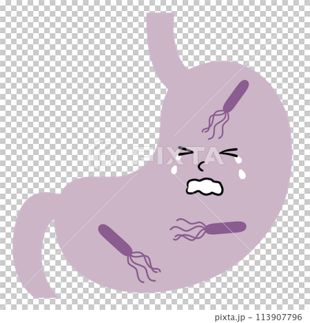 胃與幽門螺旋桿菌的插圖 113907796