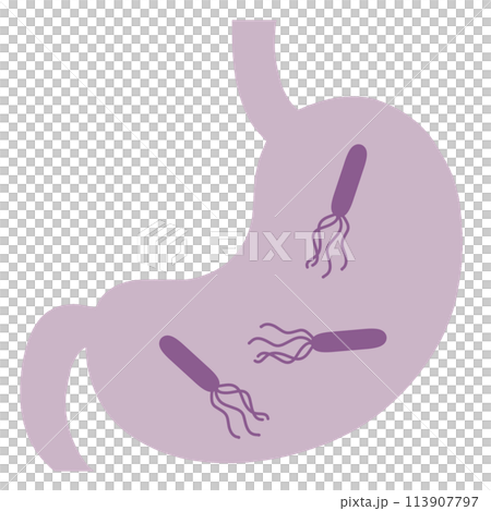 Illustration of a stomach with Helicobacter pylori 113907797