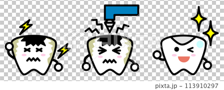 經過牙醫治療蛀牙後變得美麗的牙齒的插圖 經過牙醫治療蛀牙後變得美麗的牙齒的插圖 113910297