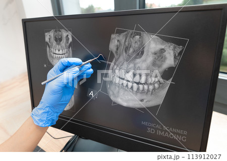 Dental consultation with 3D tomography image 113912027