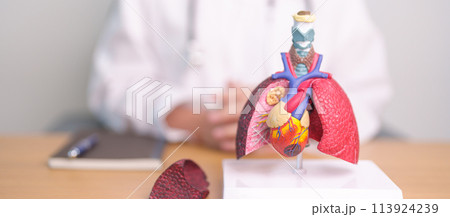 Doctor with heart Cardiovascular and Respiratory anatomy for Disease. Lung Cancer, Asthma, Chronic Obstructive Pulmonary or COPD, Bronchitis, Emphysema, Cystic Fibrosis, Bronchiectasis, Pneumonia Doctor with heart Cardiovascular and Respiratory anatomy for Disease. Lung Cancer, Asthma, Chronic Obstructive Pulmonary or COPD, Bronchitis, Emphysema, Cystic Fibrosis, Bronchiectasis, Pneumonia 113924239