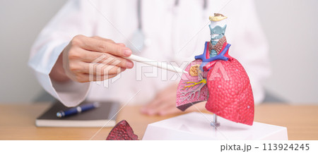 Doctor with Smoker and normal Lung anatomy for Disease. Lung Cancer, Asthma, Chronic Obstructive Pulmonary or COPD, Bronchitis, Emphysema, Cystic Fibrosis, Bronchiectasis, Pneumonia and world Lung day 113924245