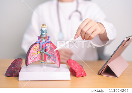 Doctor with Smoker and normal Lung anatomy for Disease. Lung Cancer, Asthma, Chronic Obstructive Pulmonary or COPD, Bronchitis, Emphysema, Cystic Fibrosis, Bronchiectasis, Pneumonia and world Lung day Doctor with Smoker and normal Lung anatomy for Disease. Lung Cancer, Asthma, Chronic Obstructive Pulmonary or COPD, Bronchitis, Emphysema, Cystic Fibrosis, Bronchiectasis, Pneumonia and world Lung day 113924265