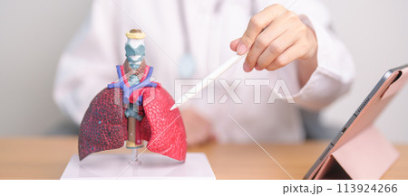 Doctor with Smoker and normal Lung anatomy for Disease. Lung Cancer, Asthma, Chronic Obstructive Pulmonary or COPD, Bronchitis, Emphysema, Cystic Fibrosis, Bronchiectasis, Pneumonia and world Lung day Doctor with Smoker and normal Lung anatomy for Disease. Lung Cancer, Asthma, Chronic Obstructive Pulmonary or COPD, Bronchitis, Emphysema, Cystic Fibrosis, Bronchiectasis, Pneumonia and world Lung day 113924266