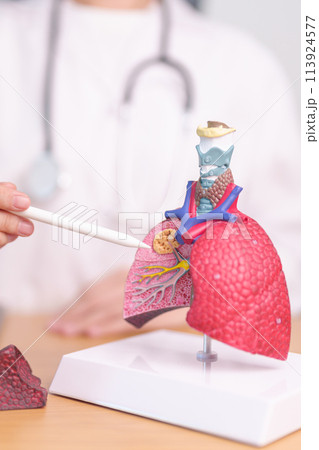 Doctor with Smoker and normal Lung anatomy for Disease. Lung Cancer, Asthma, Chronic Obstructive Pulmonary or COPD, Bronchitis, Emphysema, Cystic Fibrosis, Bronchiectasis, Pneumonia and world Lung day Doctor with Smoker and normal Lung anatomy for Disease. Lung Cancer, Asthma, Chronic Obstructive Pulmonary or COPD, Bronchitis, Emphysema, Cystic Fibrosis, Bronchiectasis, Pneumonia and world Lung day 113924577