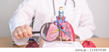 Doctor with Smoker Lung anatomy with magnifying glass. Lung Cancer, Asthma, Chronic Obstructive Pulmonary or COPD, Bronchitis, Emphysema, Cystic Fibrosis, Bronchiectasis, Pneumonia and world Lung day Doctor with Smoker Lung anatomy with magnifying glass. Lung Cancer, Asthma, Chronic Obstructive Pulmonary or COPD, Bronchitis, Emphysema, Cystic Fibrosis, Bronchiectasis, Pneumonia and world Lung day 113924586